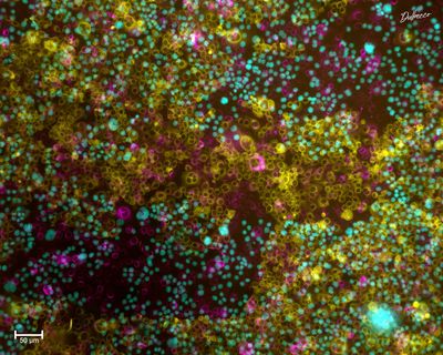 Esta obra se denomina Pollock y es una microscopía de fluorescencia de células de mono rhesus (magenta) infectadas con el Virus del Zika (amarillo) (Foto: Cortesía Dulbecco)